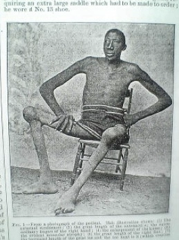 TOP 10 Giants That Actually Existed: #4 Will Defy Everything You Knew.